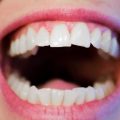 Diş Beyazlatıcı Bantlar Dişlere Zarar Verir mi?